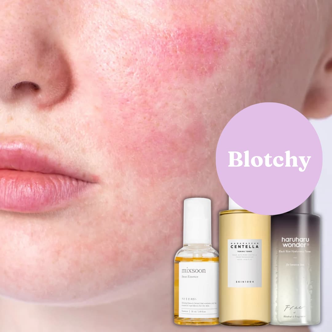 Close-up of womans face with redness and three skincare products