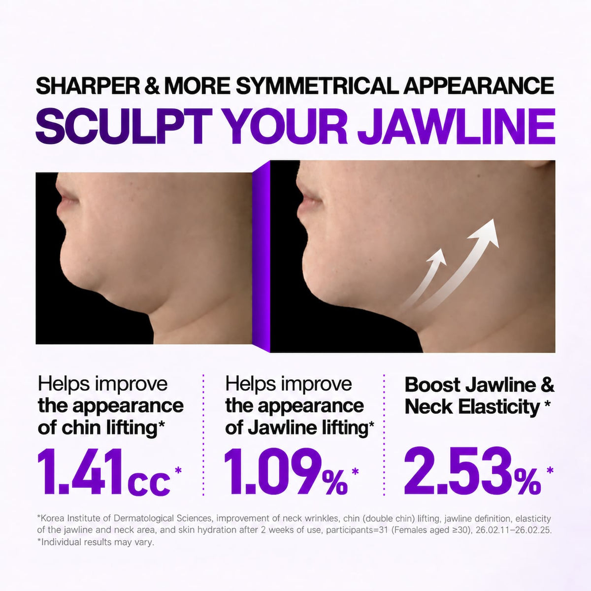 Promotional graphic for a jawline and chin lifting treatment, showing before-and-after side profile views of a woman's face with text claiming sharper and more symmetrical appearance and listed percentage improvements.