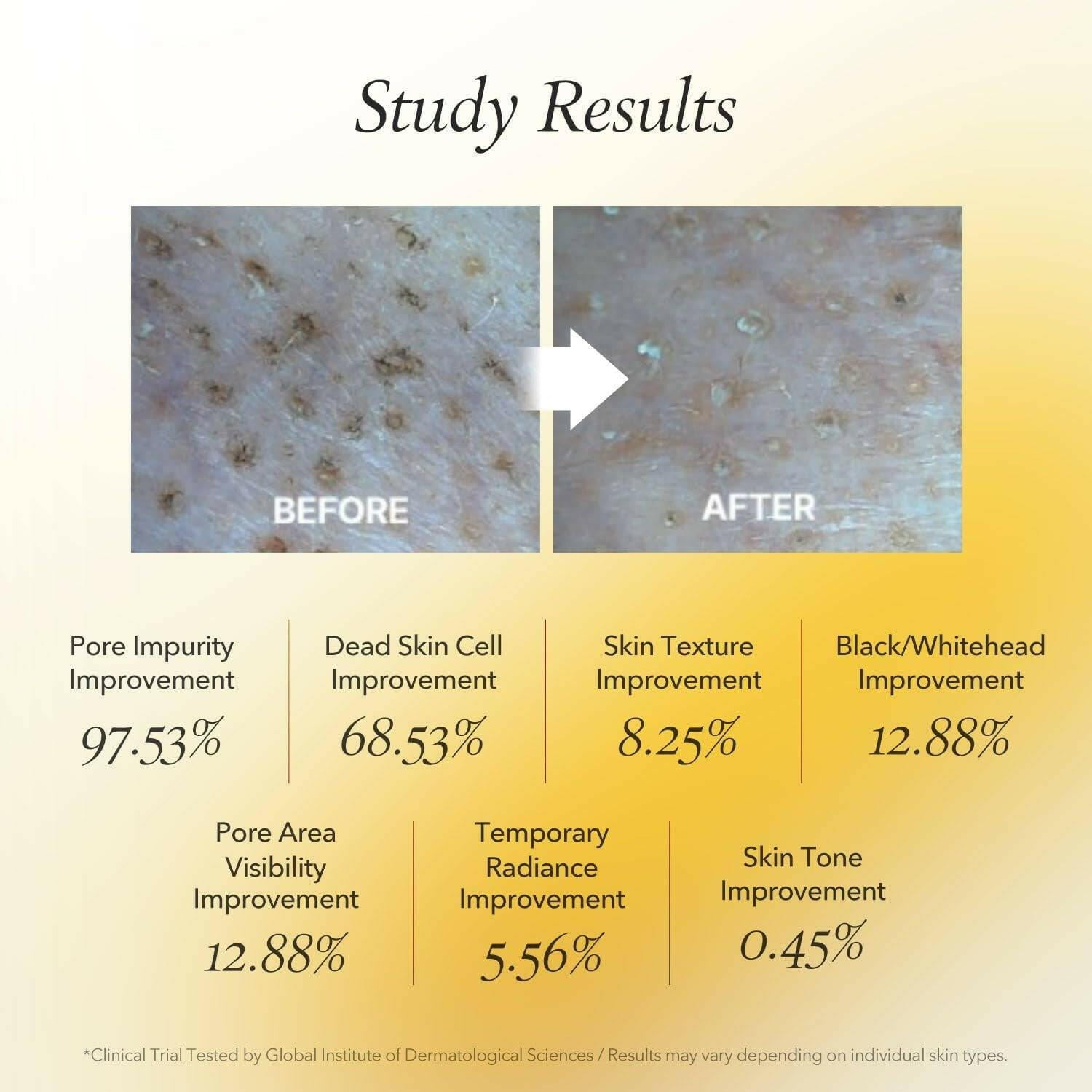APRILSKIN Real Calendula Peel Off Pack 100g - bellubeauty