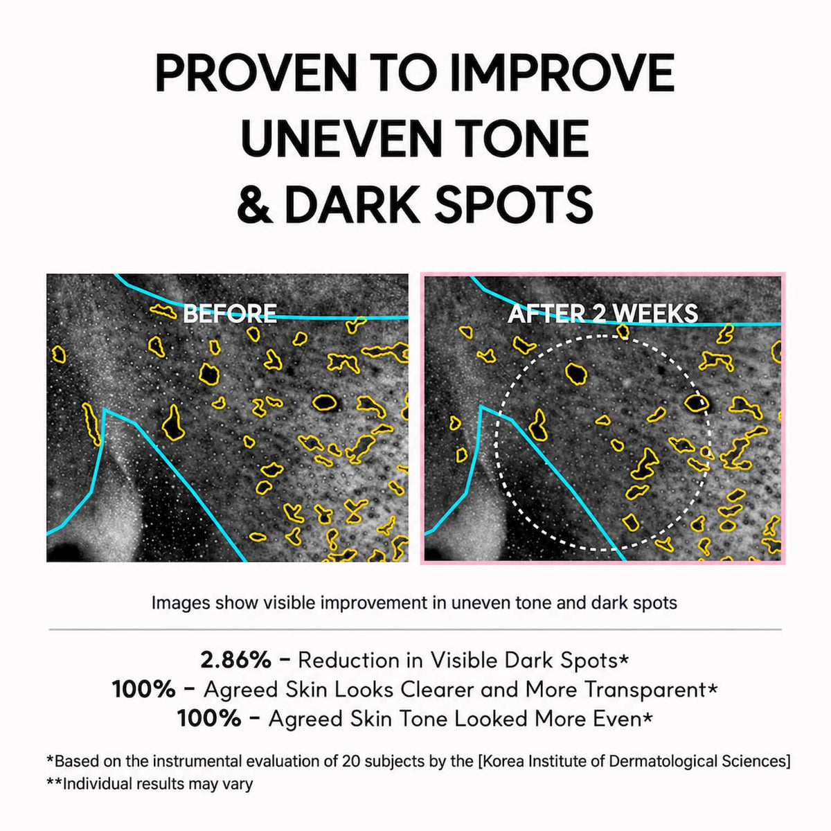 A marketing infographic with the headline 'PROVEN TO IMPROVE UNEVEN TONE & DARK SPOTS' above two before-and-after skin-tone comparison panels labeled 'BEFORE' and 'AFTER 2 WEEKS,' plus text citing a 2.86% reduction in visible dark spots and 100% agreement that skin looks clearer and more transparent.