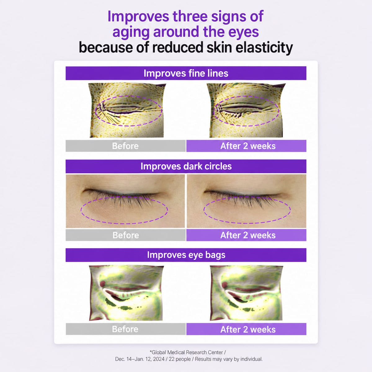 A promotional infographic with three comparison panels showing skin around the eyes before and after two weeks of use. The text at the top reads, 'Improves three signs of aging around the eyes because of reduced skin elasticity.