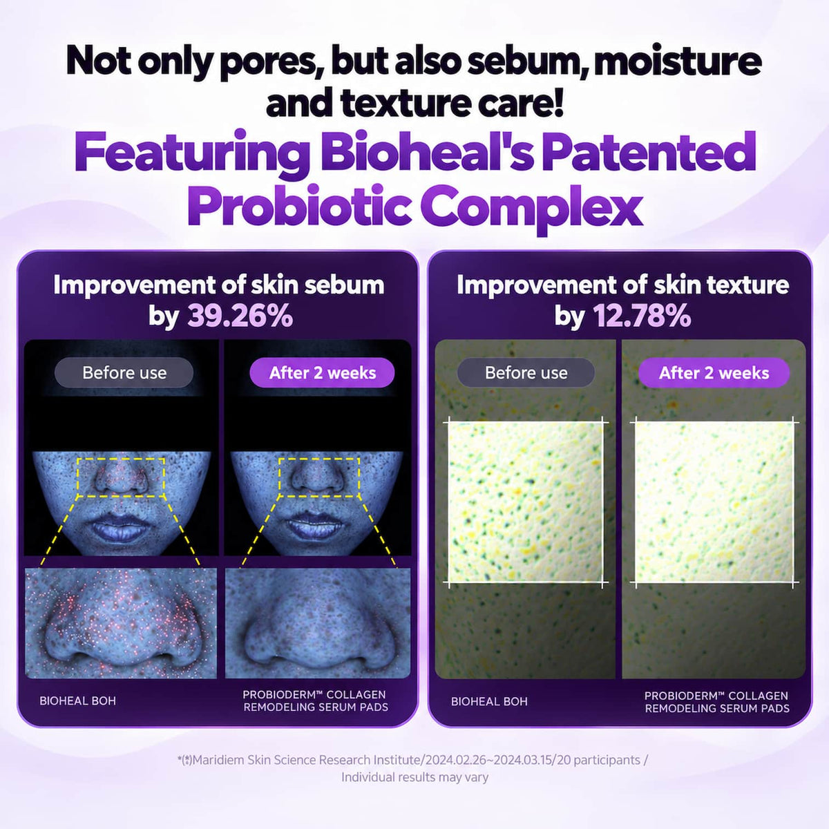 Promotional graphic for a skincare probiotic complex, featuring before-and-after skin texture and sebum improvement results with text and visual panels on a light purple background.