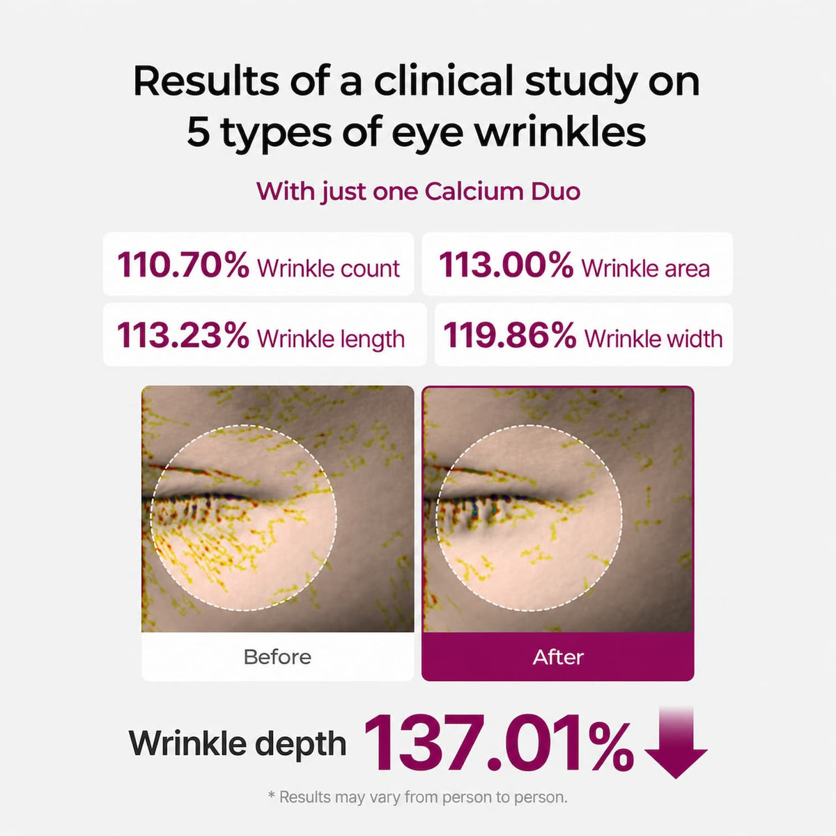 An infographic showing clinical study results on five types of eye wrinkles, with before-and-after close-up images of an eye area, percentage improvements in wrinkle count, area, length, width, and depth, and the text 'With just one Calcium Duo'.