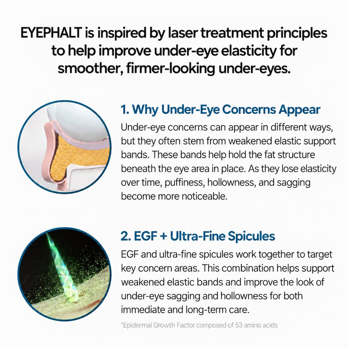 An informational graphic for EYEPHALT under-eye treatment, explaining why under-eye concerns appear and describing how EGF and ultra-fine spicules work, with two circular illustrations on a white background.