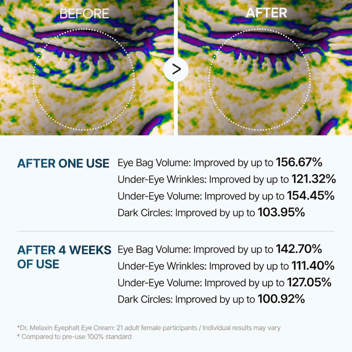 Before-and-after eye cream results infographic showing under-eye area improvement over 4 weeks, with text listing improvements in eye bag volume, under-eye wrinkles, under-eye volume, and dark circles.