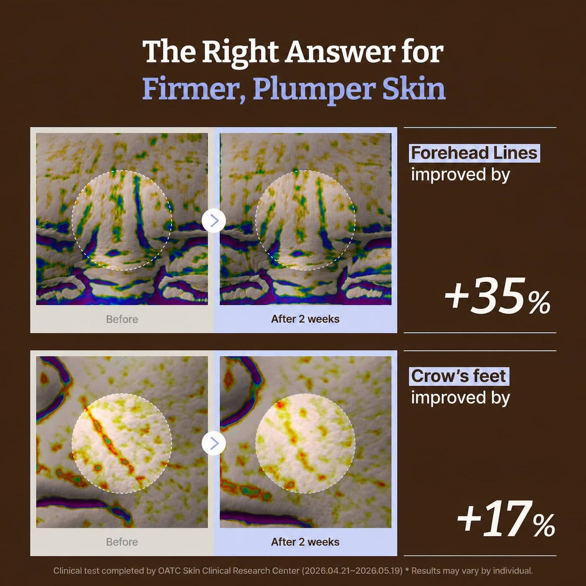 An informational graphic with the headline 'The Right Answer for Firmer, Plumper Skin' on a brown background, showing before-and-after close-up skin texture images for forehead lines and crow's feet with text stating '+35%' and '+17%'.