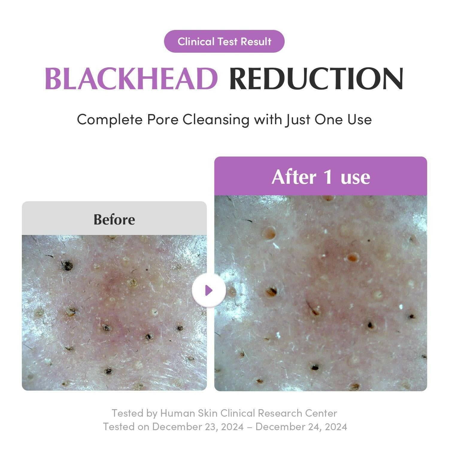 EQQUALBERRY Purple Rice Pore Purifying Pack Cleanser 130g - bellubeauty
