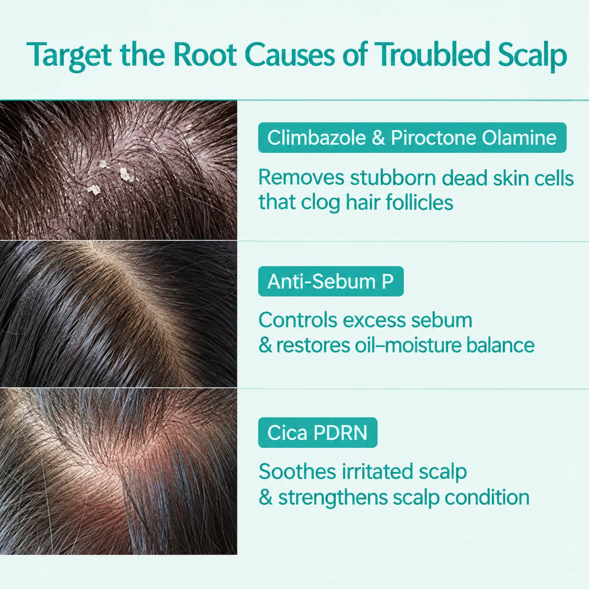 LILYEVE Scalp Turn Cica PDRN Brush Ampoule 100ml - BelluBeauty