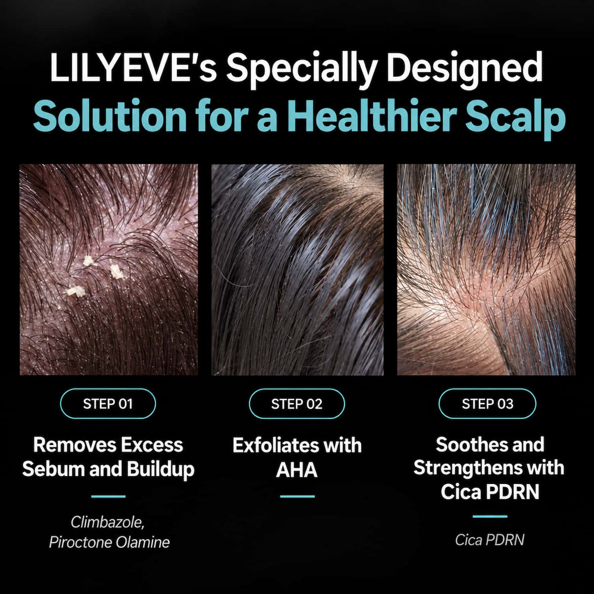 An informational graphic for LILYEVE Scalp Turn Cica PDRN Deep Clean Shampoo, showing three close-up hair/scalp photos labeled Step 01, Step 02, and Step 03 with text describing sebum removal, exfoliation, and soothing.