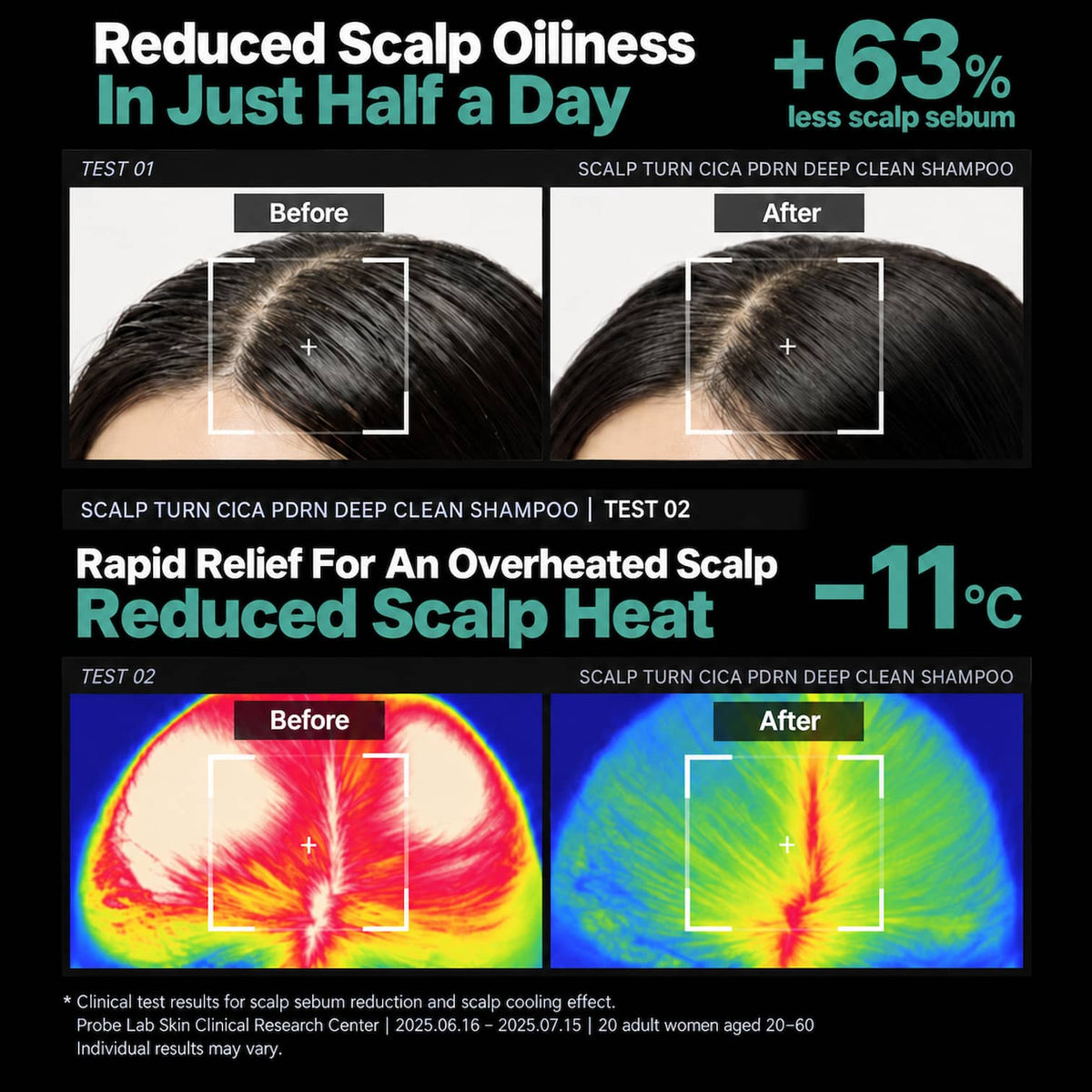 An infographic-style before-and-after marketing graphic for LILYEVE Scalp Turn Cica PDRN Deep Clean Shampoo. It features two sets of before/after scalp close-ups and thermal images demonstrating reduced scalp oiliness and relief of scalp heat.