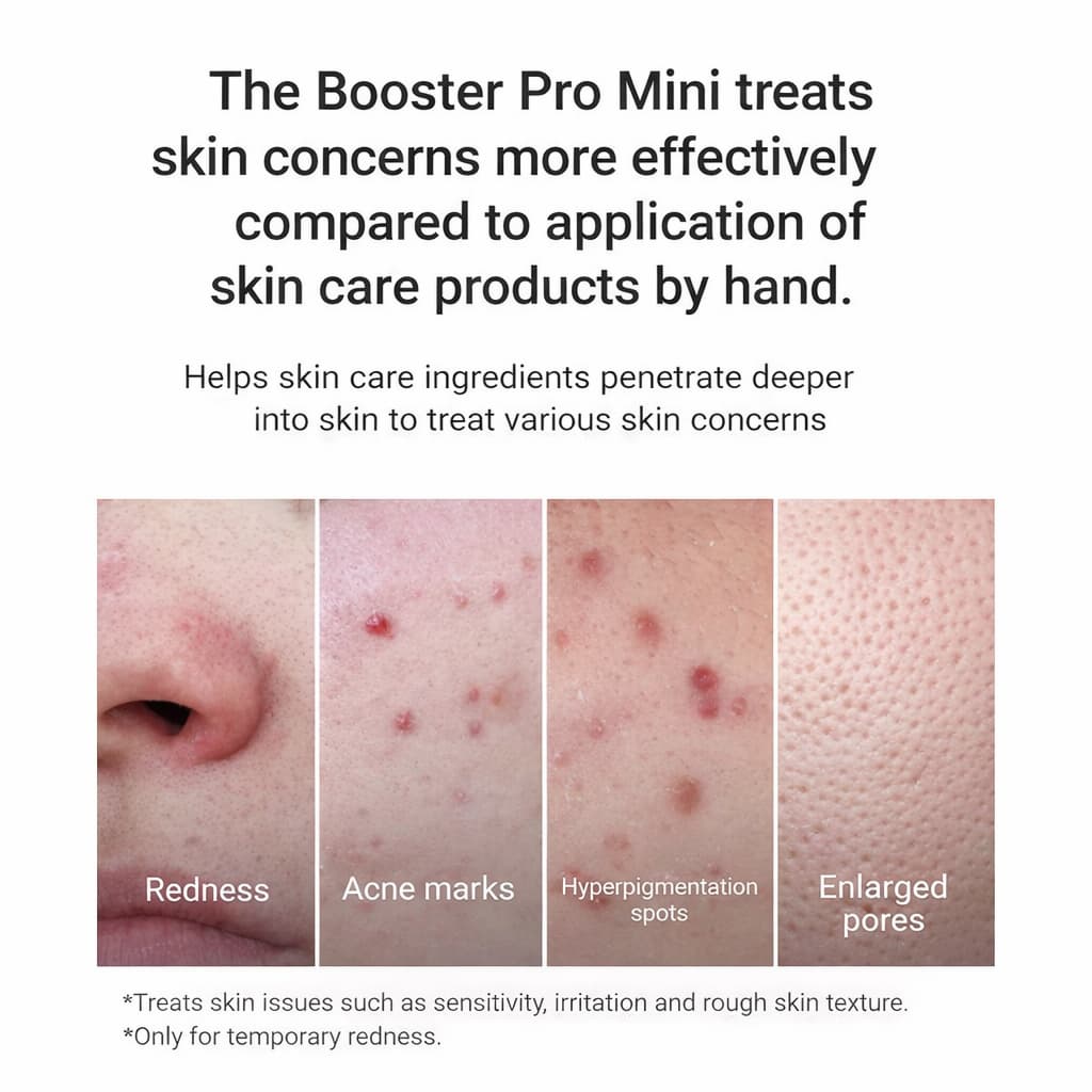 MEDICUBE AGE-R Booster Pro Mini White - BelluBeauty
