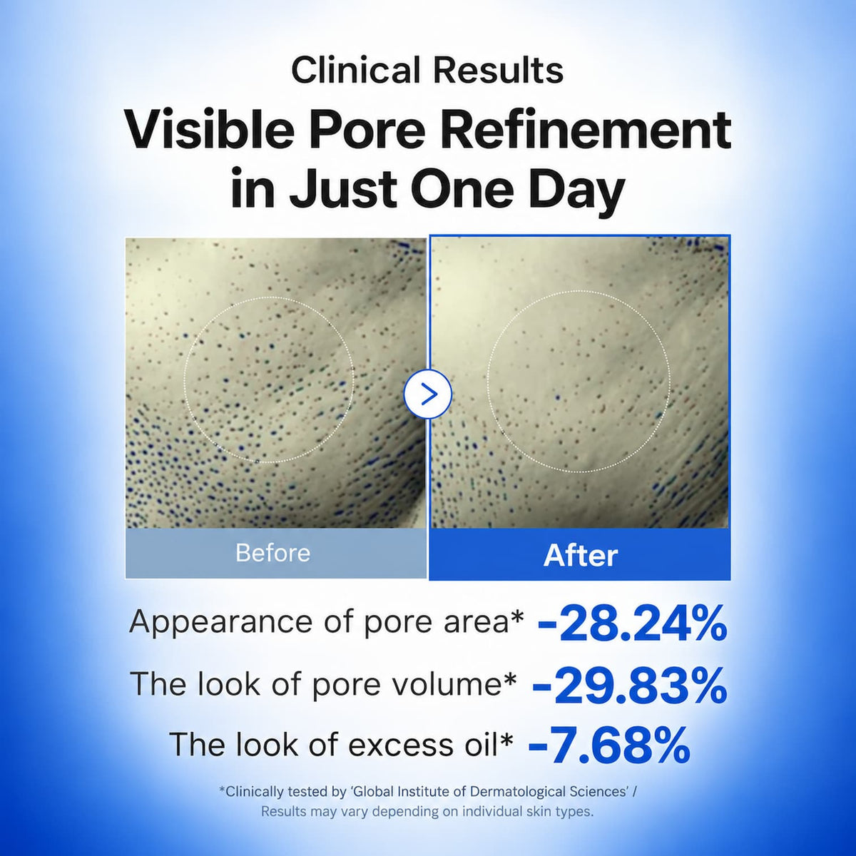 Clinical results graphic showing before-and-after pore refinement on skin, with text stating 'Visible Pore Refinement in Just One Day' and percentage improvements in pore area, pore volume, and excess oil.