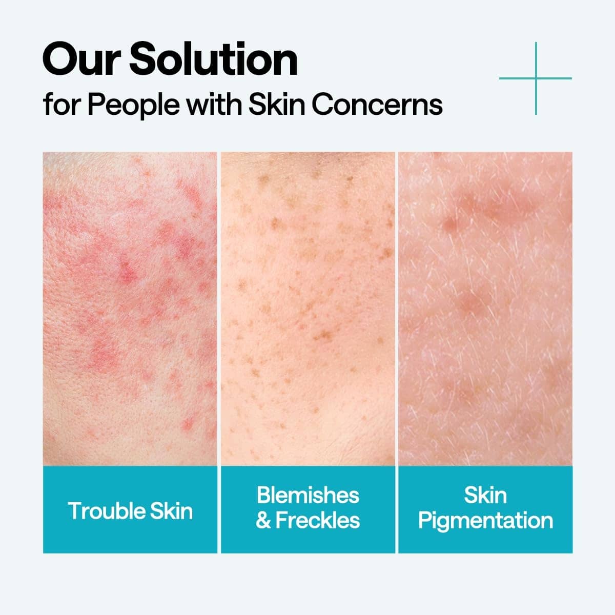 MEDIHEAL Madecassoside Blemish Repair Serum 40ml - BelluBeauty