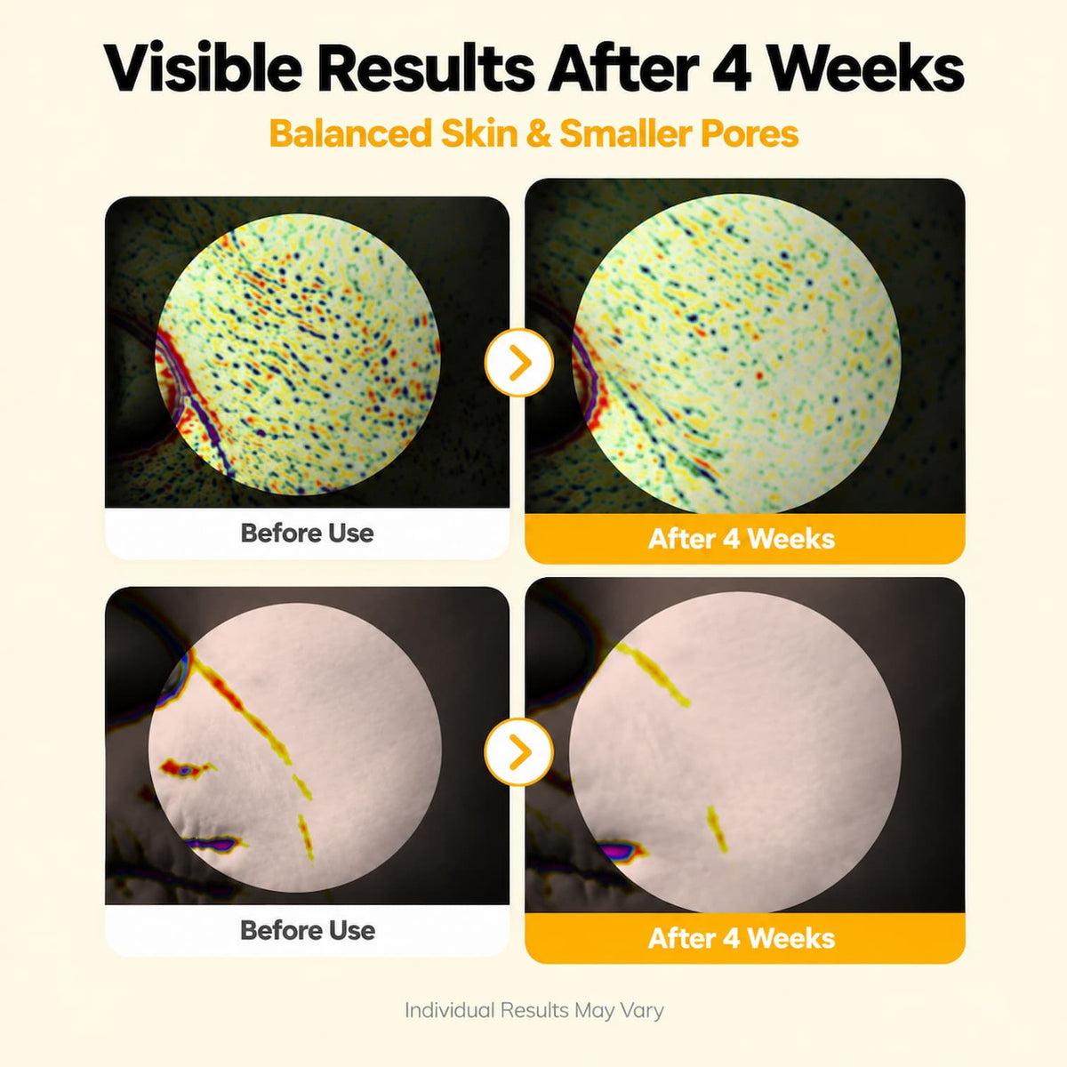 Before and after skin comparison showing visibly refined pores and improved skin texture after 4 weeks of skincare use. Individual results may vary.