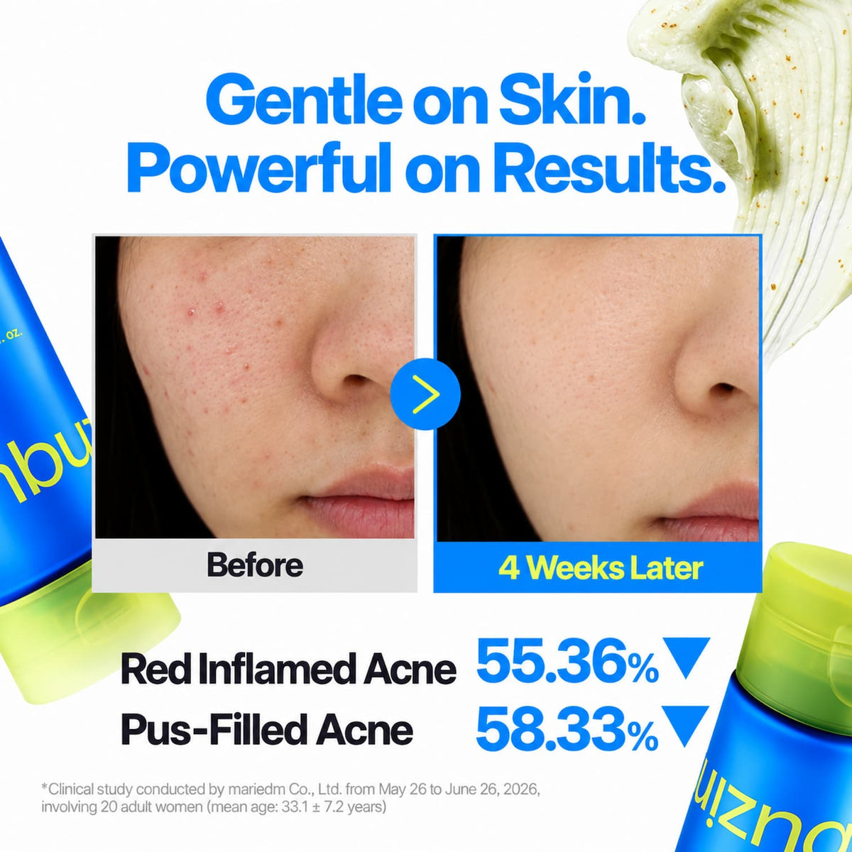 Acne treatment marketing graphic with before-and-after close-up facial skin photos, blue headline text, and product bottles partially visible at the bottom corners on a white background.