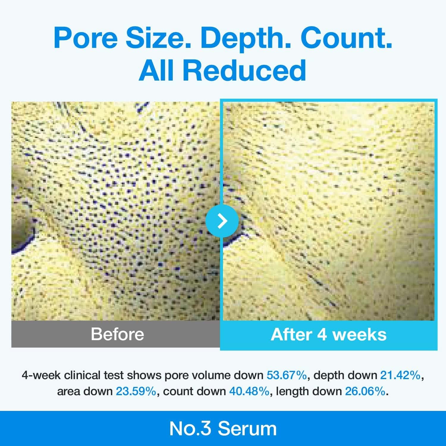 NUMBUZIN No.3 Blue Bio-Retinol Pore Refining Serum 30ml - BelluBeauty