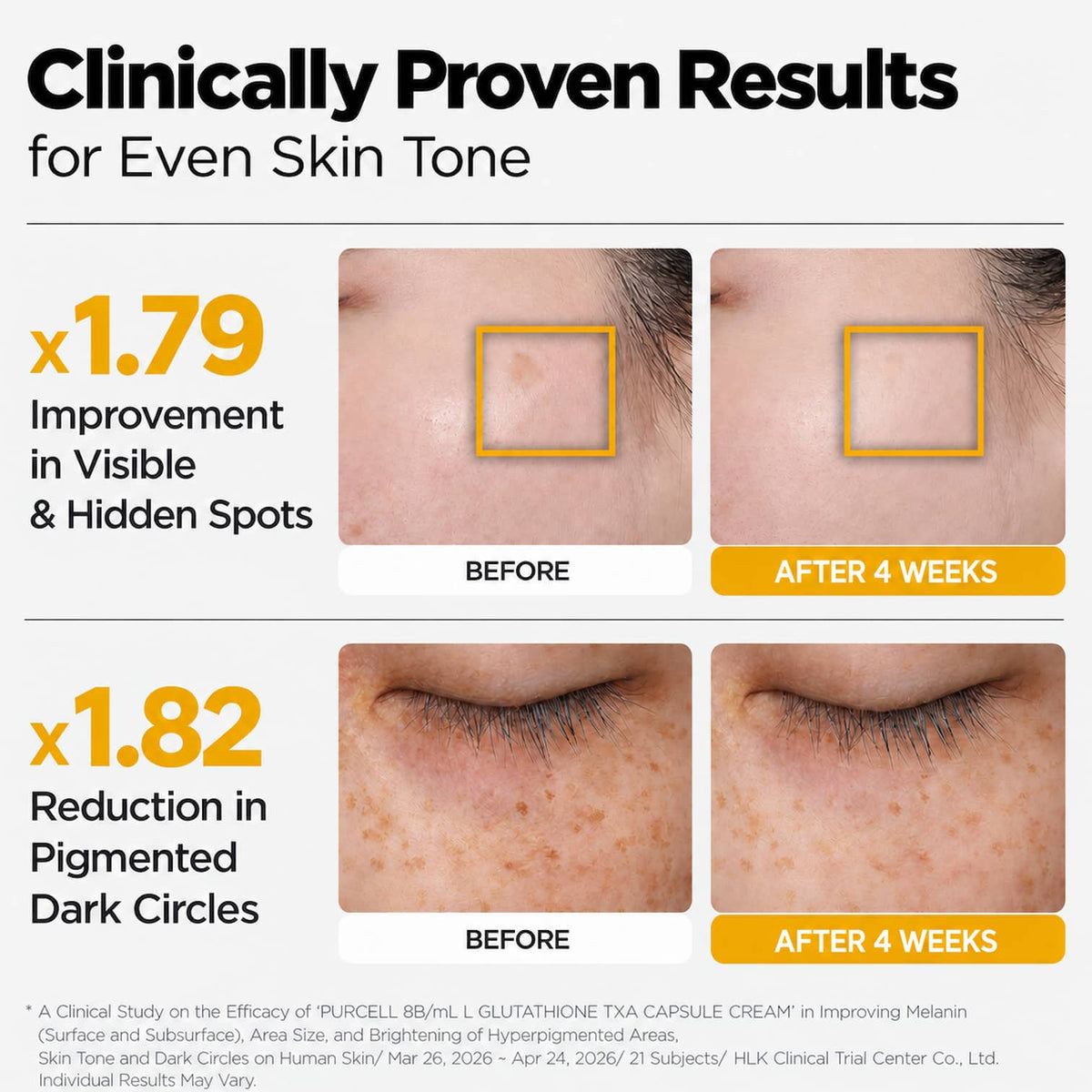 Clinical results infographic for PURCELL 8B/mL L-Glutathione TXA Capsule Cream, showing before-and-after close-ups of facial skin tone improvement and reduction in pigmented dark circles, with text stating 'Clinically Proven Results for Even Skin Tone'