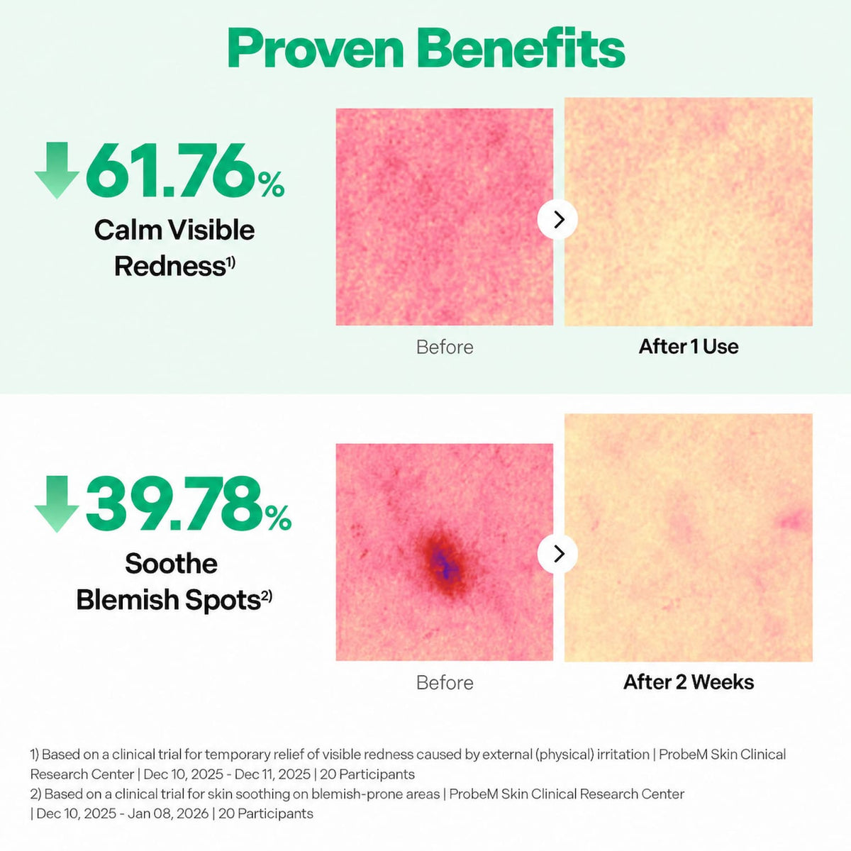 An infographic titled 'Proven Benefits' showing before-and-after skin photos with text claiming a 61.76% reduction in visible redness and a 39.78% soothing effect on blemish spots.