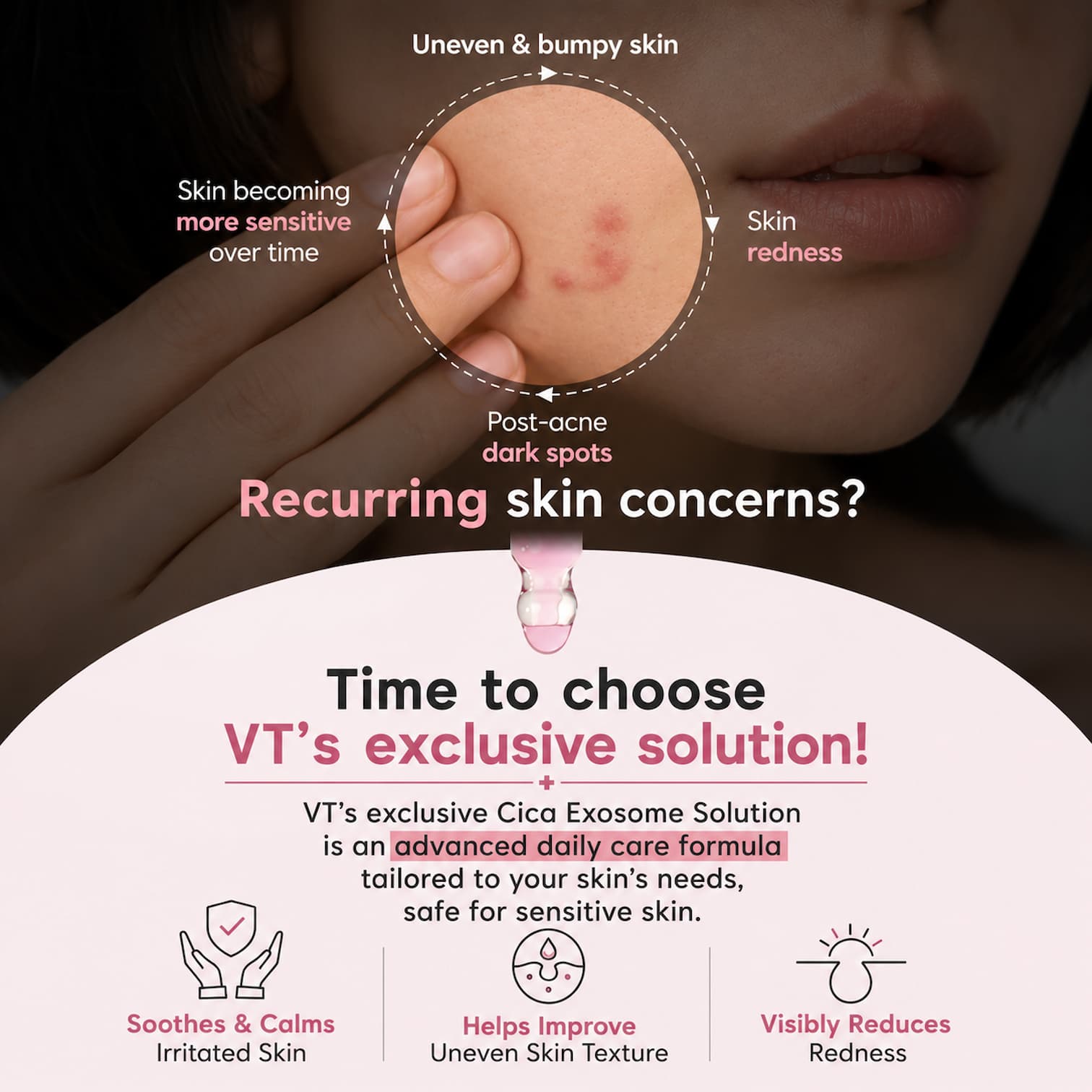 VT Azelaic A1 Calming Ampoule 30ml - BelluBeauty