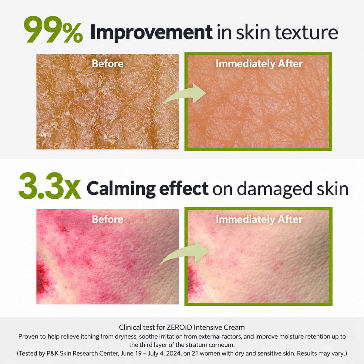 ZEROID Intensive Cream 80ml - BelluBeauty