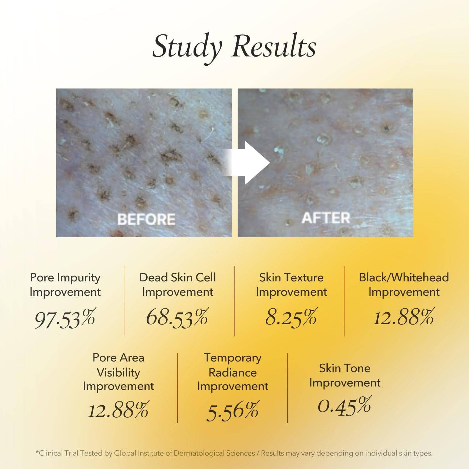 APRILSKIN Real Calendula Peel Off Pack 100g - BelluBeauty