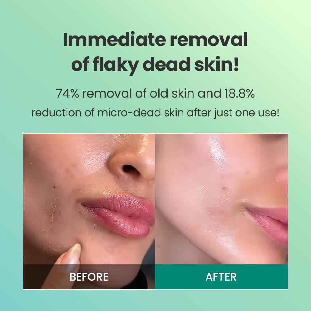 DR.G Brightening Peeling Gel 120g - BelluBeauty