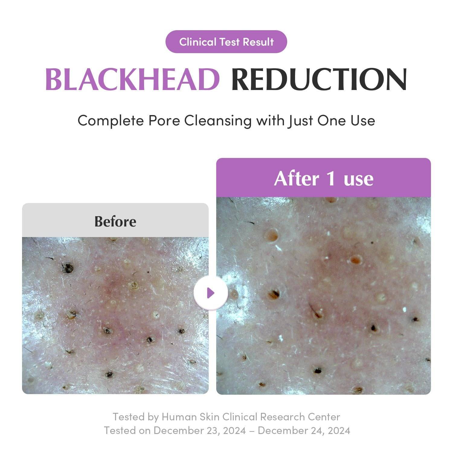 EQQUALBERRY Purple Rice Pore Purifying Pack Cleanser 130g - BelluBeauty