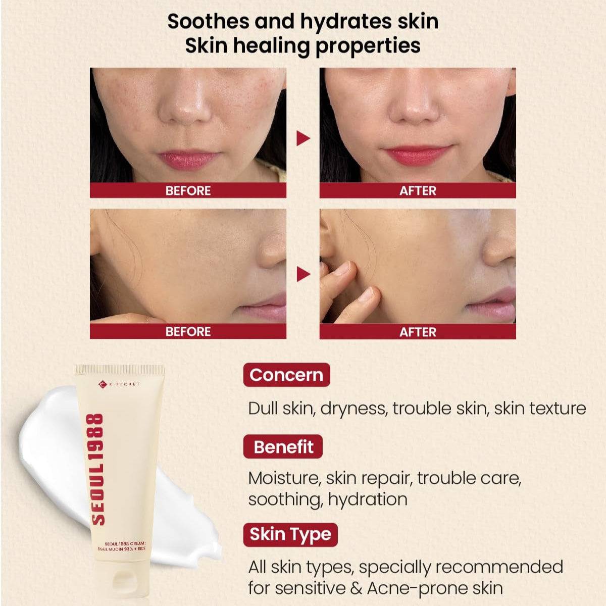 KSECRET Seoul 1988 Cream Snail Mucin 93% + Rice 100ml - BelluBeauty