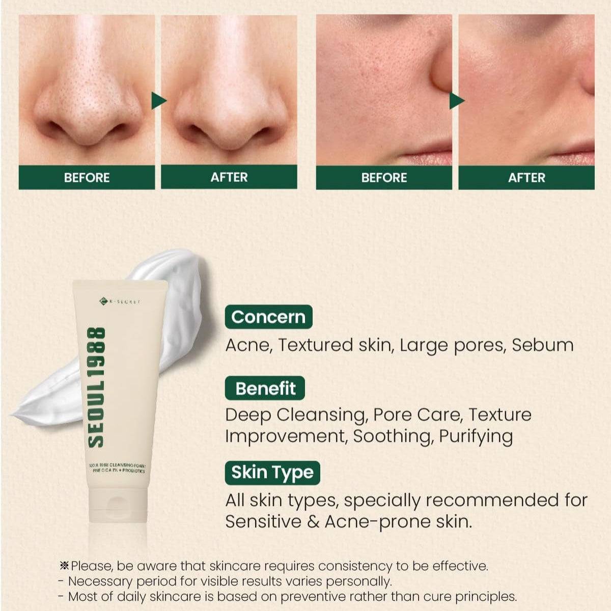 KSECRET Seoul 1988 Cleansing Foam Pine Cica 1% + Probiotics 150ml - BelluBeauty