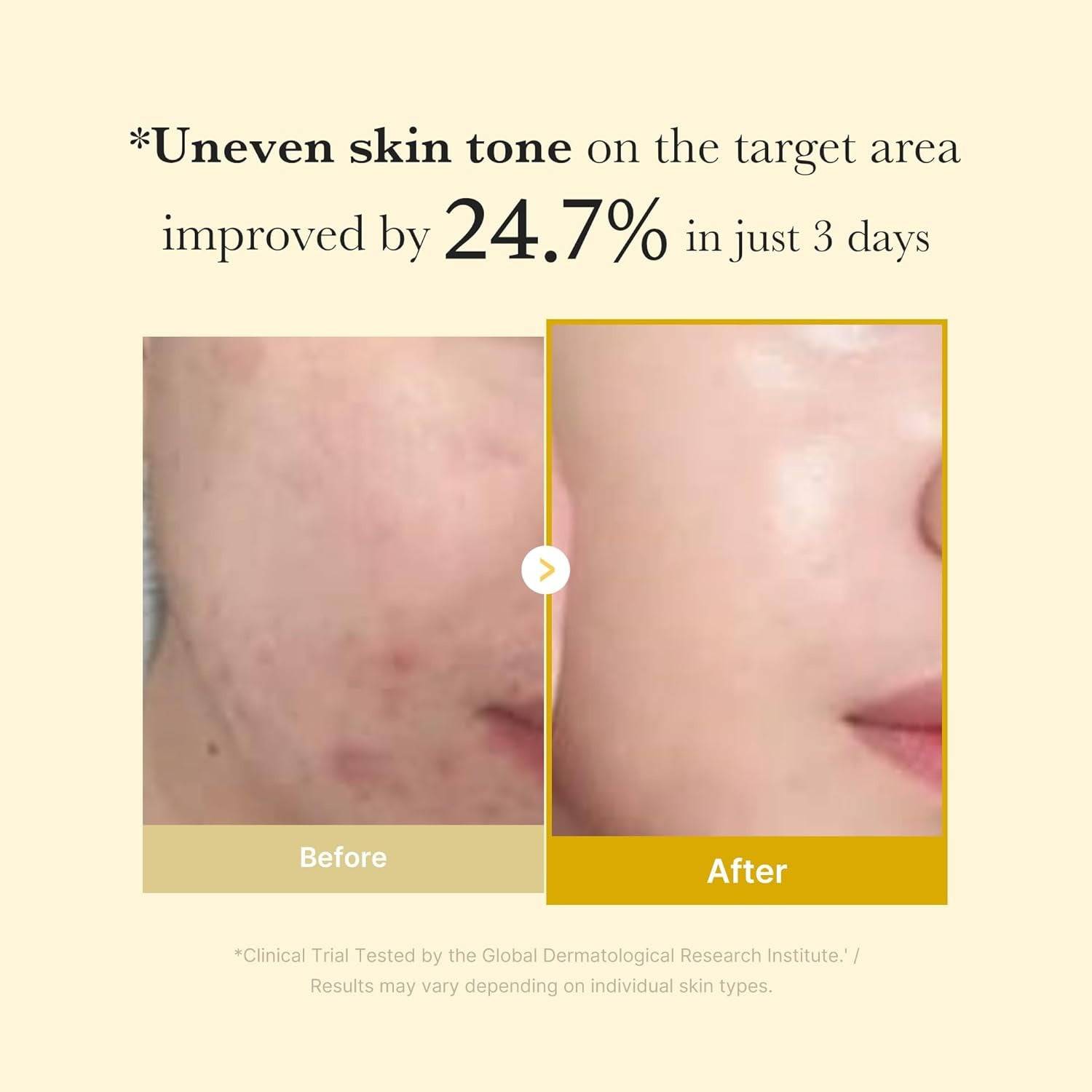 MEDICUBE Kojic Acid Tumeric Night Wrapping Mask 75ml - BelluBeauty