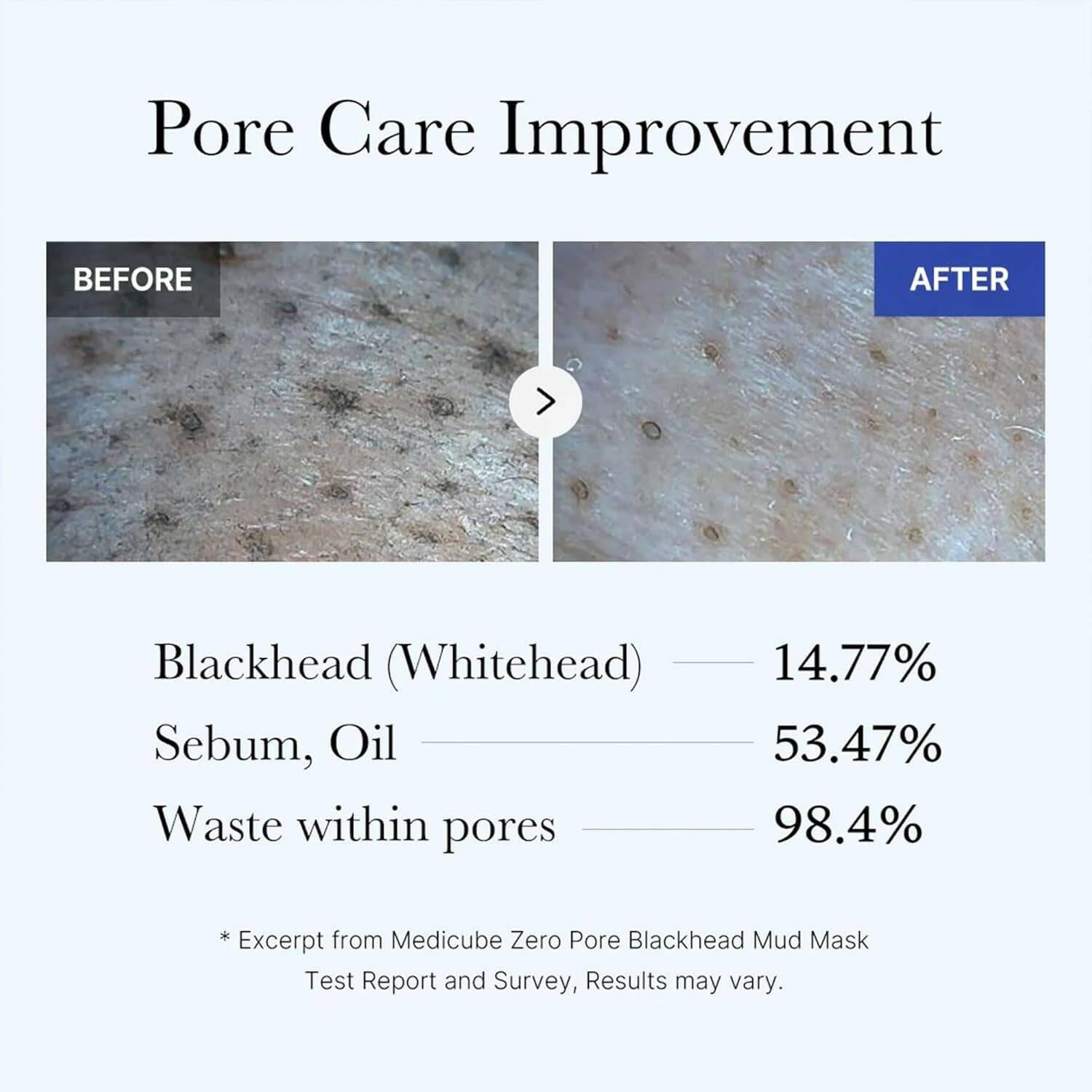 MEDICUBE Zero Pore Blackhead Mask 100g - bellubeauty